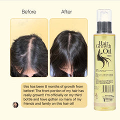 Hair Growth Oil