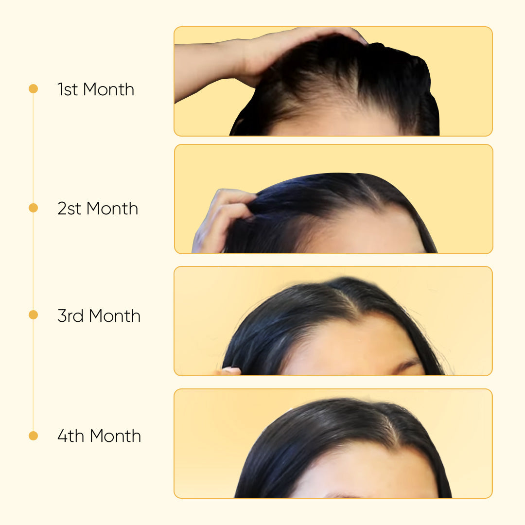 Hair Growth Oil